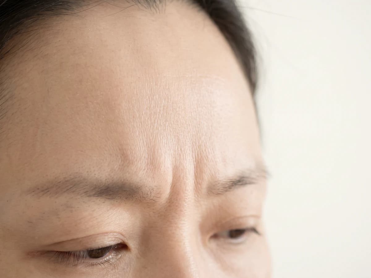 미간을 찌푸릴 때 세로 주름이 생기는 이마 사진