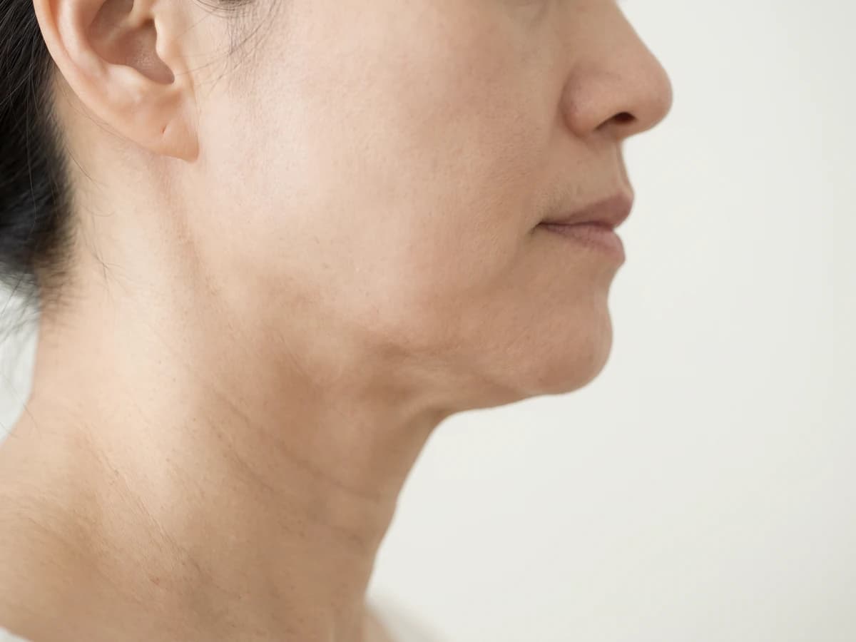 턱선 아래로 피부가 내려앉고 목에 가는 주름이 보이는 옆모습 사진